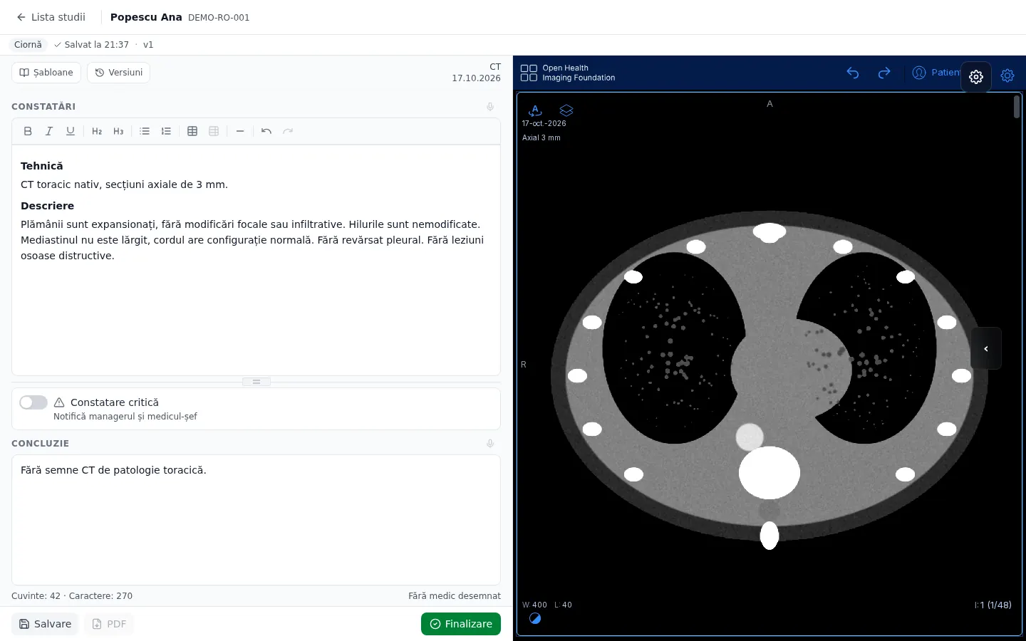 Editorul de raport ClearScan (date demonstrative)