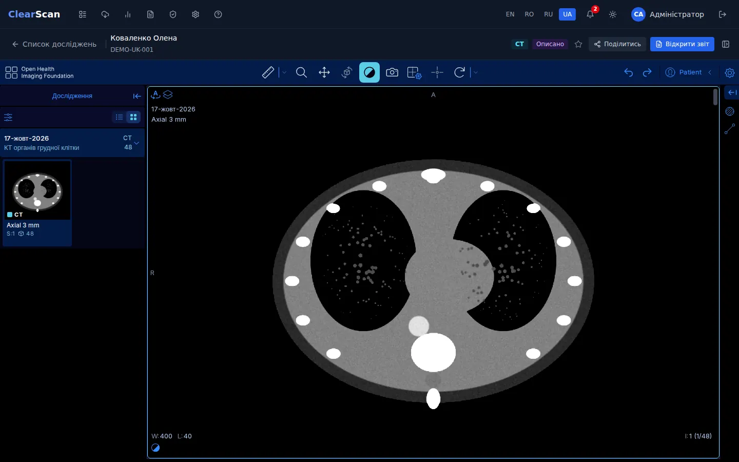 Переглядач досліджень ClearScan (демонстраційні дані)