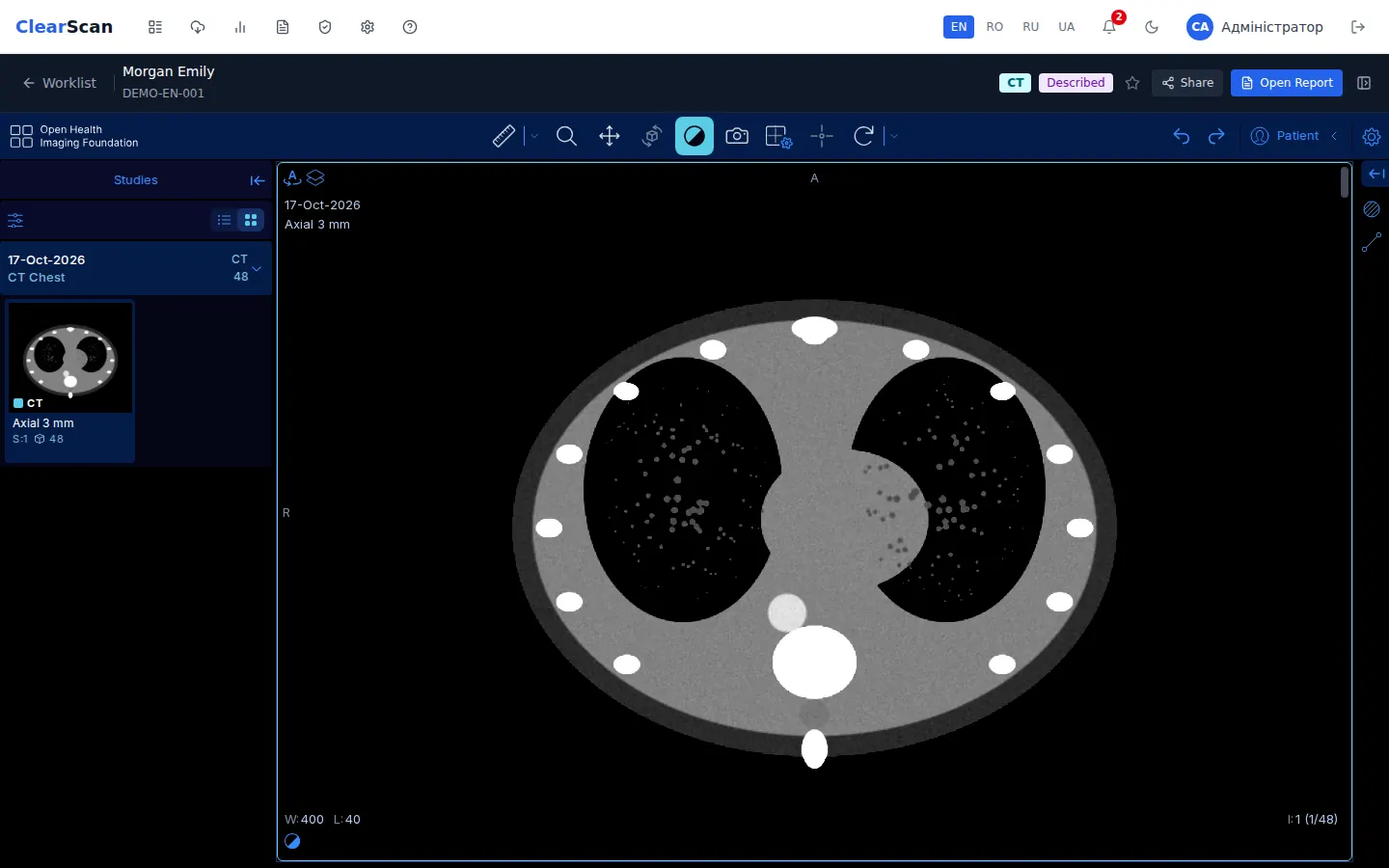ClearScan study viewer (demo data)