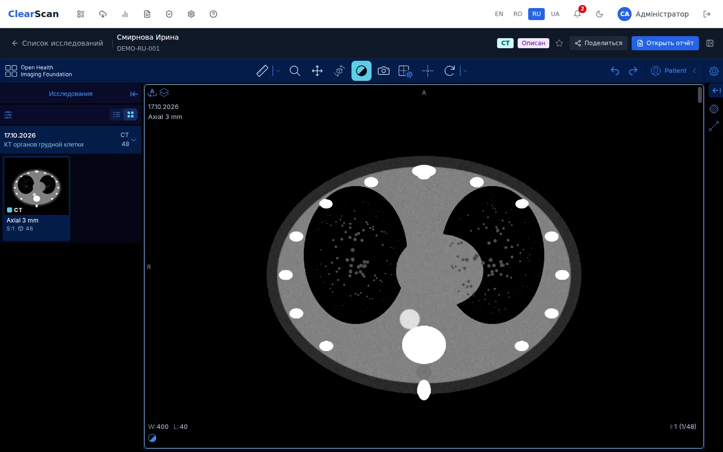 Просмотрщик исследований ClearScan (демонстрационные данные)
